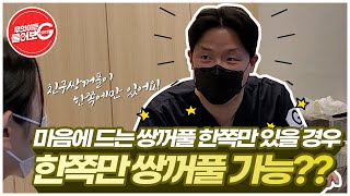 한쪽만쌍꺼풀 이 있을 때 한쪽만 쌍꺼풀 수술 가능할까 [upl. by Jeramey945]