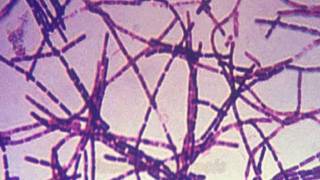 Anthrax and Bacillus anthracis [upl. by Fauver]