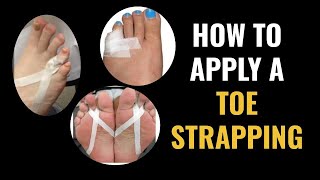 How Do I Do Toe Strapping Dislocated and Fractured Toe [upl. by Inait914]