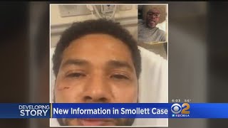 Reports Chicago Police Believe Jussie Smollett Orchestrated Attack [upl. by Chun307]