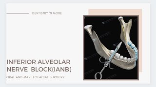 INFERIOR ALVEOLAR NERVE BLOCK [upl. by Emmott23]