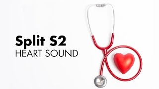 Fixed Split S2  Heart Sounds  MEDZCOOL [upl. by Garvin845]