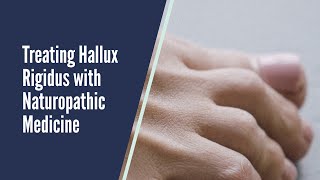 Treating Hallux Rigidus with Naturopathic Medicine [upl. by Radman]