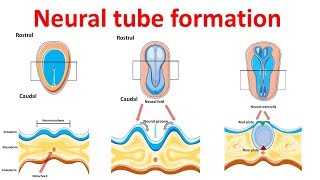 neural tube formation  Embryology  Neurulation [upl. by Ayatan596]