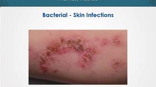 Bacterial skin infections  Dermatology  EduRx [upl. by Aihsia]