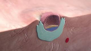 Implantation of the blastocyst [upl. by Sublett22]