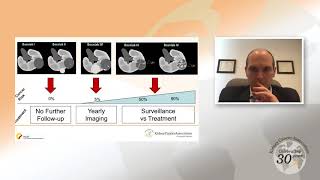 Small Renal Masses An Overview [upl. by Amoihc886]