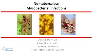 Nontuberculous Mycobacterial Infections 2019 [upl. by Kamaria]