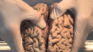 Introduction Neuroanatomy Video Lab  Brain Dissections [upl. by Ries]