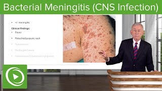 Bacterial Meningitis CNS Infection – Infectious Diseases  Lecturio [upl. by Naols]