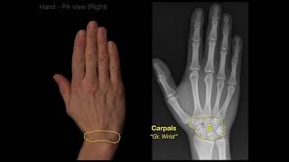 Anatomy of Hand XraysRevised [upl. by Ainitsirc406]