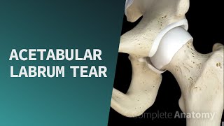 Acetabular Labrum Tear  Pathologies [upl. by Della120]