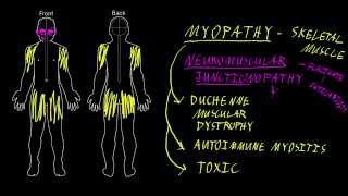 Neuropathy vs myopathy on EMG [upl. by Nylarac]