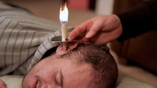 The danger of ear candling [upl. by Sivlek]