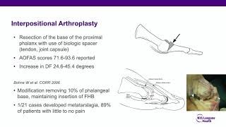 Hallux Rigidus  ABOS Orthopedic Surgery Board Exam Review [upl. by Nomma833]