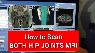 Hip Joints MRI Scan Protocol Positioning amp Planning  Live Demo on GE 15 Tesla [upl. by Ayekat697]