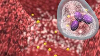 Bacterial infection and host response [upl. by Helsell]