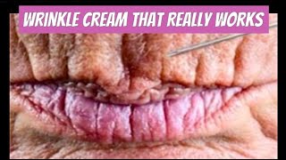 Wrinkle Cream That Really Works TRUE REVIEW [upl. by Odracir]