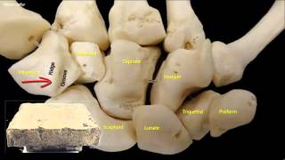 Osteology of the hand [upl. by Acirrej]