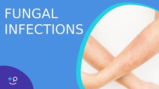 Fungal Infections  Causes Prevention and Cure [upl. by Afira503]