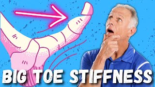 Big Toe PainStiffness Hallux Rigidus 10 Steps to Cure [upl. by Dedra249]