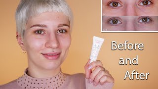 Avene Soothing Eye Contour Cream  Before amp After [upl. by Rooke]